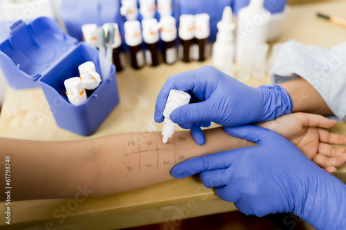 Fotografía Allergy - skin prick tests