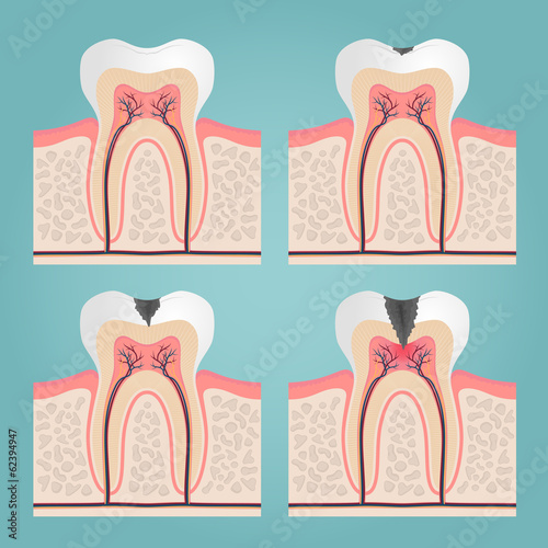 Obraz w ramie tooth anatomy