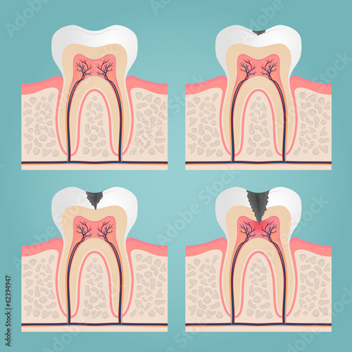 Nowoczesny obraz na płótnie tooth anatomy