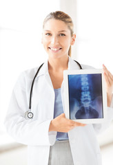 Poster - female doctor with x-ray on tablet pc