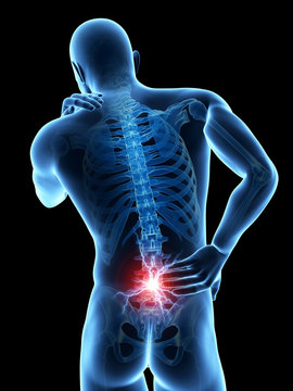 a man having acute pain in the back