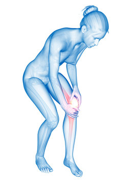medical illustration - woman having pain in the knee