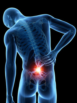 a man having acute pain in the back