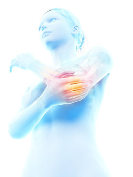 woman having acute pain in the elbow joint