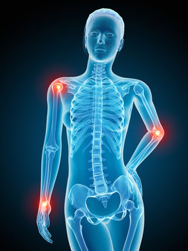 woman with painful joints