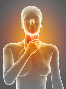medical illustration of a female with an inflamed larynx