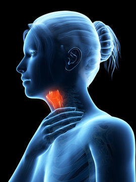 medical illustration of a female with an inflamed larynx