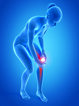 medical illustration - woman having pain in the knee