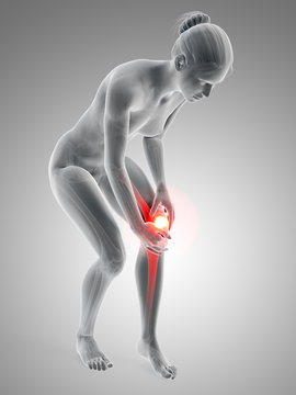 medical illustration - woman having pain in the knee