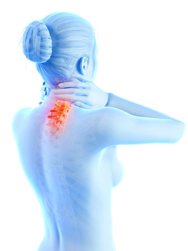 woman having a painful neck - visible spine
