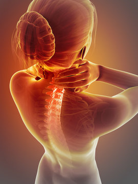 woman having a painful neck - visible spine