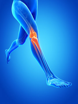 woman running - showing a painful knee