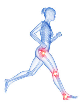 woman running - painful leg joints