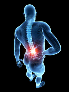 a man having acute pain in the back