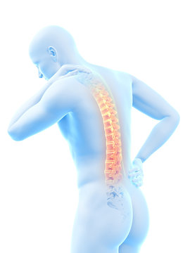 a man having acute pain in the back