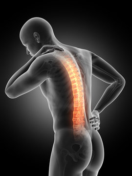 a man having acute pain in the back
