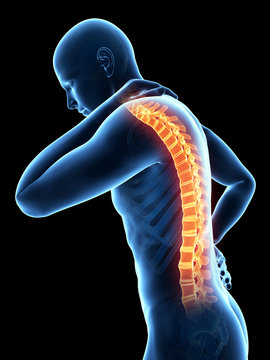 a man having acute pain in the back