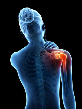a woman having acute pain in the shoulder joint