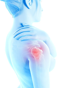 a woman having acute pain in the shoulder joint