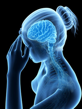 medical illustration of a woman having a headache