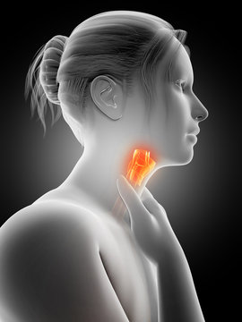 medical illustration of a female with an inflamed larynx