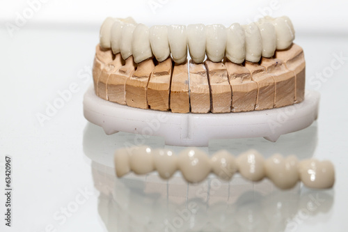 Fotografia, Obraz Zirconium Porcelain Tooth plate in Dentist Store