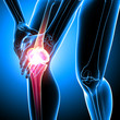 © pankajstock123 - Human knee pain anatomy on blue