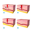 Anatomy of  tissue repair in human skin