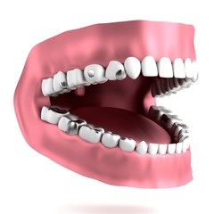 Wall Mural - realistic 3d render of human teeth with fillings