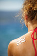 © ZoomTeam - girl back with sunburn and wave of sun lotion