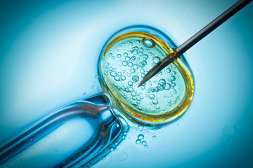 Wall Mural - In vitro fertilisation, IVF macro concept