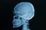 Fototapeta Do akwarium - skull x-rays image