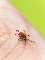 Wall Mural - Castor bean tick, Ixodes ricinus crawling on human skin