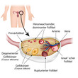 Anatomie Eierstock und Follikelzyklus