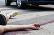 © Photographee.eu - Unconscious woman at accident scene