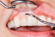 © Ocskay Bence - Dental examination