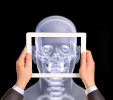 Man Hands Using Tablet Pc. Image Of X-ray Head On Screen