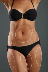 Poster - Plastic surgery. Liposuction. Slim body concept