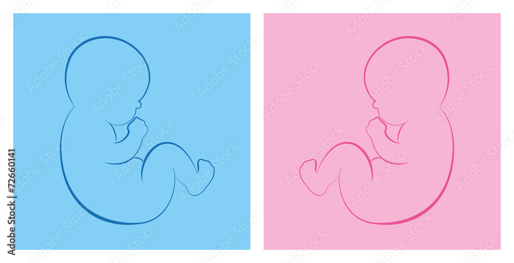 Baby Blue Boy Pink Girl Stock Vector | Adobe Stock
