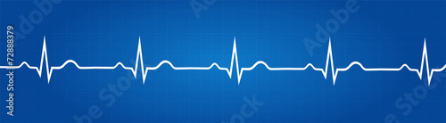 Fotografía Blueprint Of Normal Electrocardiogram Graphic
