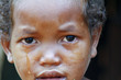 © dr322 - Crying girl with tear on cheek - poor african child