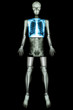 © stockdevil - Lung healthy (X-ray Whole body )