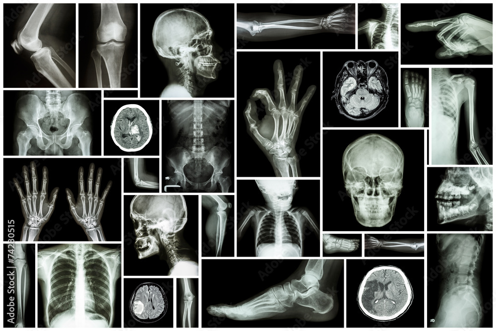 Human Collection Collection X-ray multiple part of human Stock Photo | Adobe Stock