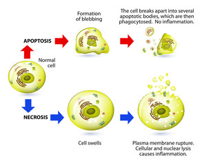 Apoptosis and necrosis. Difference.