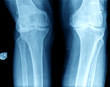 © oceandigital - knee x-ray