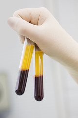 Blood tubes in two layers divided by centrifuge after