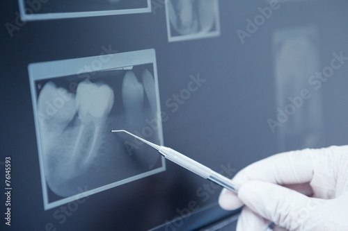 Poster Gloved hand holding dental tool to teeth x-ray