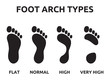 Foot arch types