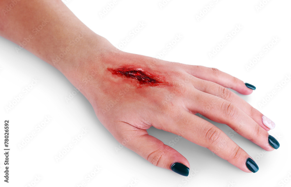 Injured hand with blood isolated on white