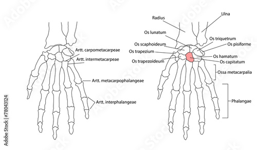 Picture Of Left Hand Bones - picture of